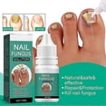 thumbnail image 5 of Fungal Nail Treatment For Toenails Extra Strong-nail Fungus Treatment For Anti, 5 of 5