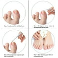 thumbnail image 5 of Professional Ingrown Toenail Set with Breathable Ingrown Toenail Strips, Curved Toenails Corrector Patch, Painless File and Lifter Pedicure Tools, 5 of 9