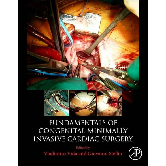 Fundamentals of Congenital Minimally Invasive Cardiac Surgery, (Paperback)