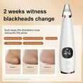 thumbnail image 4 of Blackhead Remover Pore Vacuum, Visible Facial Pore Ceaner, Skin Care Tool for Acne Pimples with Magnification, Blackhead Extractor, Used for Extraction of Acne and Blackhead, 4 of 6