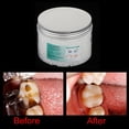 thumbnail image 3 of Kit de reparación de relleno dental temporal Perlas de relleno dental térmico Adhesivo dental para 300ml, 3 of 9
