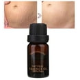Bienvenido Stretch Marks Pregnancy Scar Repair Essential Skin