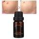 thumbnail image 4 of Estrías Embarazo Cicatriz Reparación Esencial Piel Hidratante Aceite Esencial nutritivo 10g, 4 of 8