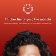 Keeps Minoxidil Solution 5% for Men - Topical Hair Regrowth - 3 Month Supply (3 x 2 fl oz Bottles)