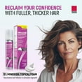 thumbnail image 4 of Taro Minoxidil for Women 5% Topical Aerosol Foam - Clinically Proven Hair Growth Solution - 2.11 Oz (2 Months Supply) - Minoxidil Foam for Women, Hair Thinning Treatment, 4 of 5