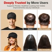 LED Red and Blue Light Hair Growth Cap, Scalp Care Device for Thicker and Healthier Hair