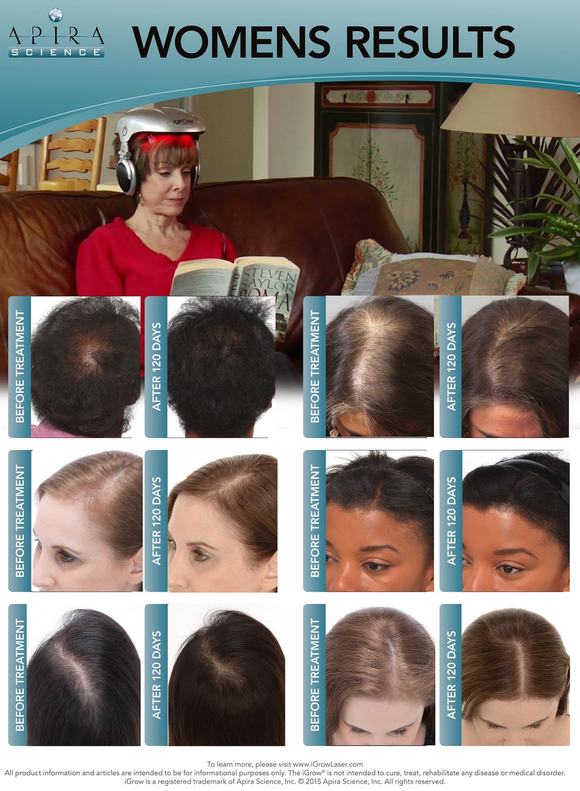 Igrow Laser Igrow Hair Growth System Walmart Com Walmart Com Igrow Laser Igrow Hair Growth System Walmart Com Walmart Com