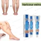 thumbnail image 2 of Pomada de medicina Herbal Natural china para venas varicosas, Vasculitis, inflamación, masaje de piernas, crema de venas varicosas, 2 of 5
