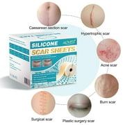 Aliver Silicone Scar Roll, 120-inch Scar Removal Sheets for Surgery Scar Tape Roll for C-Section, Painless