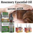 thumbnail image 2 of Rosemary Hair Growth Oil Fast Growing Anti Hair Loss, 2 of 5