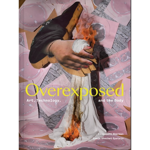 Overexposed: Art, Technology, and the Body, (Hardcover)