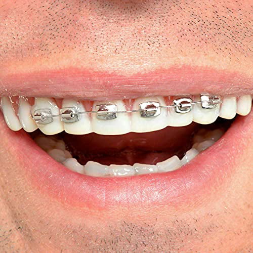 Fool-All Braces Fake Teeth Standard by Billy Bob 