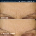 thumbnail image 6 of RoC Retinol Correxion Line Smoothing Max Hydration Cream, Clinical Retinol + Hyaluronic Acid, Fragrance-Free Face & Neck Moisturizer, 48-Hour Hydration, 1.7 oz, 6 of 14
