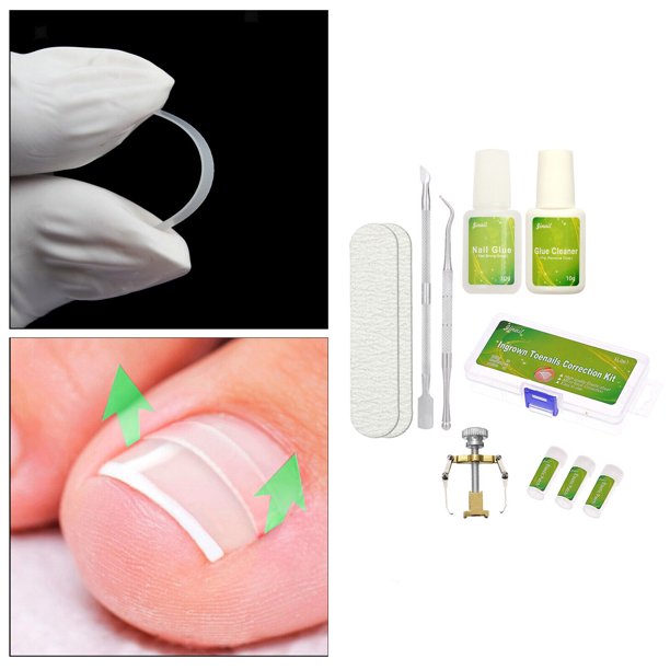 Professional Ingrown Pincer Toenail Correction Sticker Pedicure Toenail