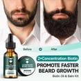 thumbnail image 2 of Kit de crecimiento de barba MistySprite 2X Biotina para hombres con aceites, 2 of 7