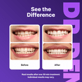 thumbnail image 2 of DrDent Professional Teeth Whitening Strips 7 Treatments - Safe for Enamel - Non Sensitive Teeth Whitening - Whitening Without Any Harm - Pack of 14 Strips + Mouth Opener Included, 2 of 5