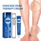 thumbnail image 1 of Crema de masaje intravenoso, venas varicosas calmantes cansadas y pesadas para eliminar la aparición de venas varicosas, 25 g (en caja) kaili Sencillez, 1 of 5