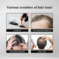 thumbnail image 4 of East Moon Hair Growth Liquid Moisturizing Hair Growth Thick Anti-Drop Hair Repair Scalp Massage Care, 4 of 5