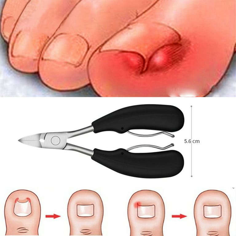 SDJMa Toe Nail Clipper for Ingrown or Thick Toenails,Toenails