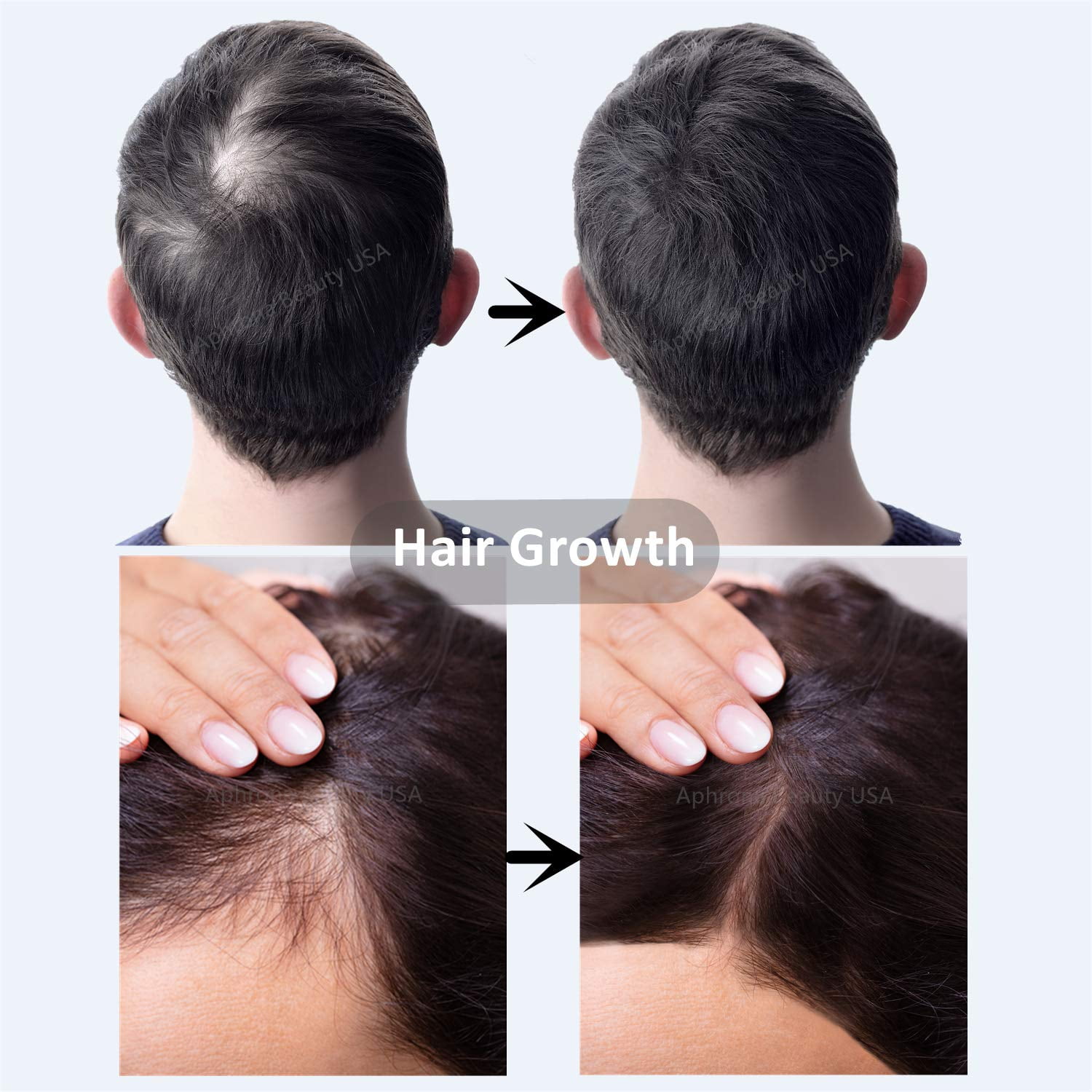 Buy Aphrona Laser Hair Growth HelmetFDA Cleared Lasers Hair Loss