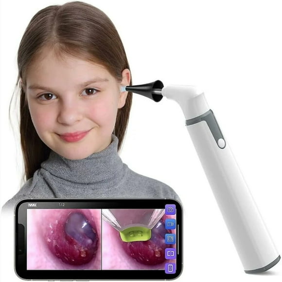 Ear Wax Removal Solution, Innovative Endoscope Otoscope with Patented Multi-Use Tool & Wireless Connected Technology for Safe and Efficient Ear Care