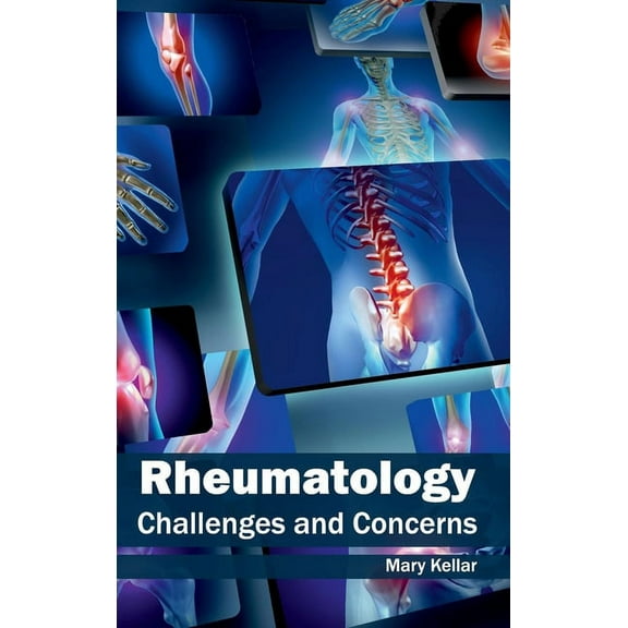 Rheumatology: Challenges and Concerns, (Hardcover)