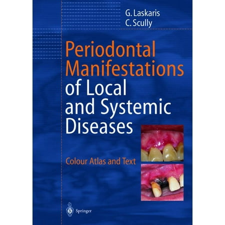 UPC: 9783642627880 | Periodontal Manifestations of Local and Systemic Diseases: Colour Atlas and Text (Paperback)