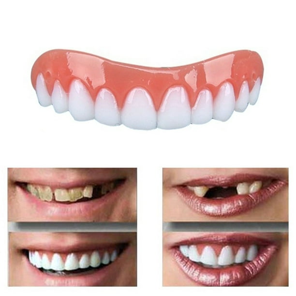 Professional Perfect Smile Veneers Dub In Stock For Correction Of Teeth For Bad Teeth Perfect Smile Veneers Walmart Com Walmart Com