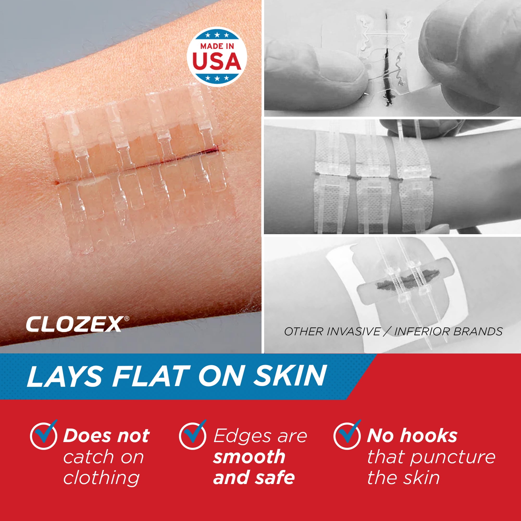 Clozex Emergency Laceration Kit - Repair Wounds Without Stitches