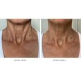 thumbnail image 2 of Cuello y escote ultrareafirmantes Dry Oil City Beauty, 2 of 9