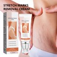 thumbnail image 4 of Stretch Mark Cream, 2Pcs 45g Scar Removal Cream Firming Skin  for Body, 4 of 8