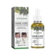 thumbnail image 1 of Jaysuing Scalp Hair Oil Essence Massage Scalp Hair Moisturizing Hair Care Essence - 60Ml |, 1 of 4
