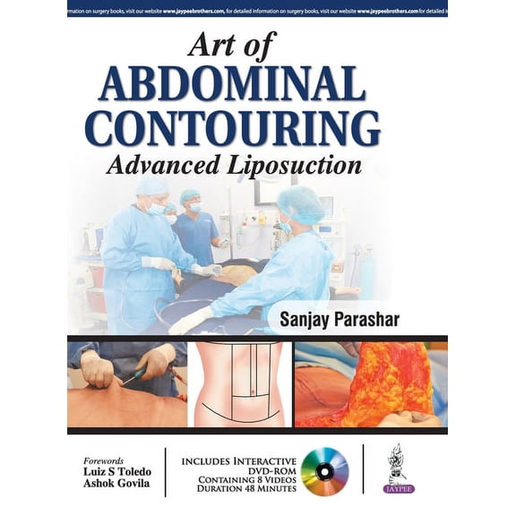 Art of Abdominal Contouring: Advanced Liposuction, (Hardcover)