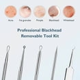 thumbnail image 7 of Blackhead remover lumps Popper tool kit with diagonal tweezers, 7 of 7