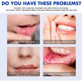 thumbnail image 2 of Tratamientos para el alivio del dolor de dientes Spray Limpiador de Periodontitis de 30ml, cura para el dolor de muelas, elimina el cuidado del dolor de la Periodontitis y las aftas, 2 of 5