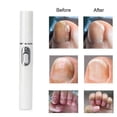 thumbnail image 4 of 1 Pcs Anti Fungal Onychomycosis Repair Pen Home Set Laser Pen Blue Light Finger Toe, 4 of 4