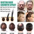 thumbnail image 3 of IBeaLee Hair Care Liquid is a strong and nutritious hair care solution that prevents hair loss, moisturizes the roots, thickens the scalp, and provides massage nutrition, 3 of 5
