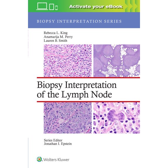 Biopsy Interpretation: Biopsy Interpretation of the Lymph Node (Hardcover)