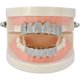 thumbnail image 2 of Parrilla Iced-Out Grillz chapada en oro de 18 quilates con barras de moldura adicionales incluidas Xemadio LRWJ452-6, 2 of 3