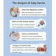 thumbnail image 5 of Umbilical Hernia Belt For Babies, Medical Child Belly Band Infant Abdominal Binder, Newborn Baby Hernia Support Truss Kids Navel Belly Button Band - S, 5 of 5