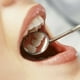 thumbnail image 5 of 6uds Herramientas dentales Dental Acero inoxidable Scaler Scaler Remover anti-niebla Juego de espejo Cuidado Belleza, 5 of 5