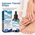thumbnail image 1 of Gotas para Uñas Encarnadas, Cuidado y Tratamiento de Uñas (30 Ml) | Ingredientes Naturales | Alivia El Dolor | Suaviza Las Cutículas | Salud de Los Dedos | Fácil de Usar, 1 of 7