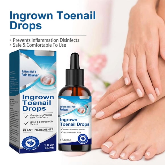 Fiudx Gotas para Uñas Encarnadas, Cuidado de Uñas con Ingredientes Herbales Naturales, Líquido Analgésico para Suavizar Cutículas, Promueve La Salud de Los Dedos de Los Pies para Uso Regular, Ideal p