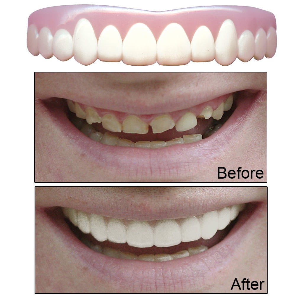 Fake Teeth That Look Real TeethWalls