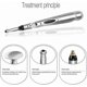 thumbnail image 2 of Acupuncture Pen Meridian Pain Relief Massager Body Massage, Electronic Meridian, 2 of 4