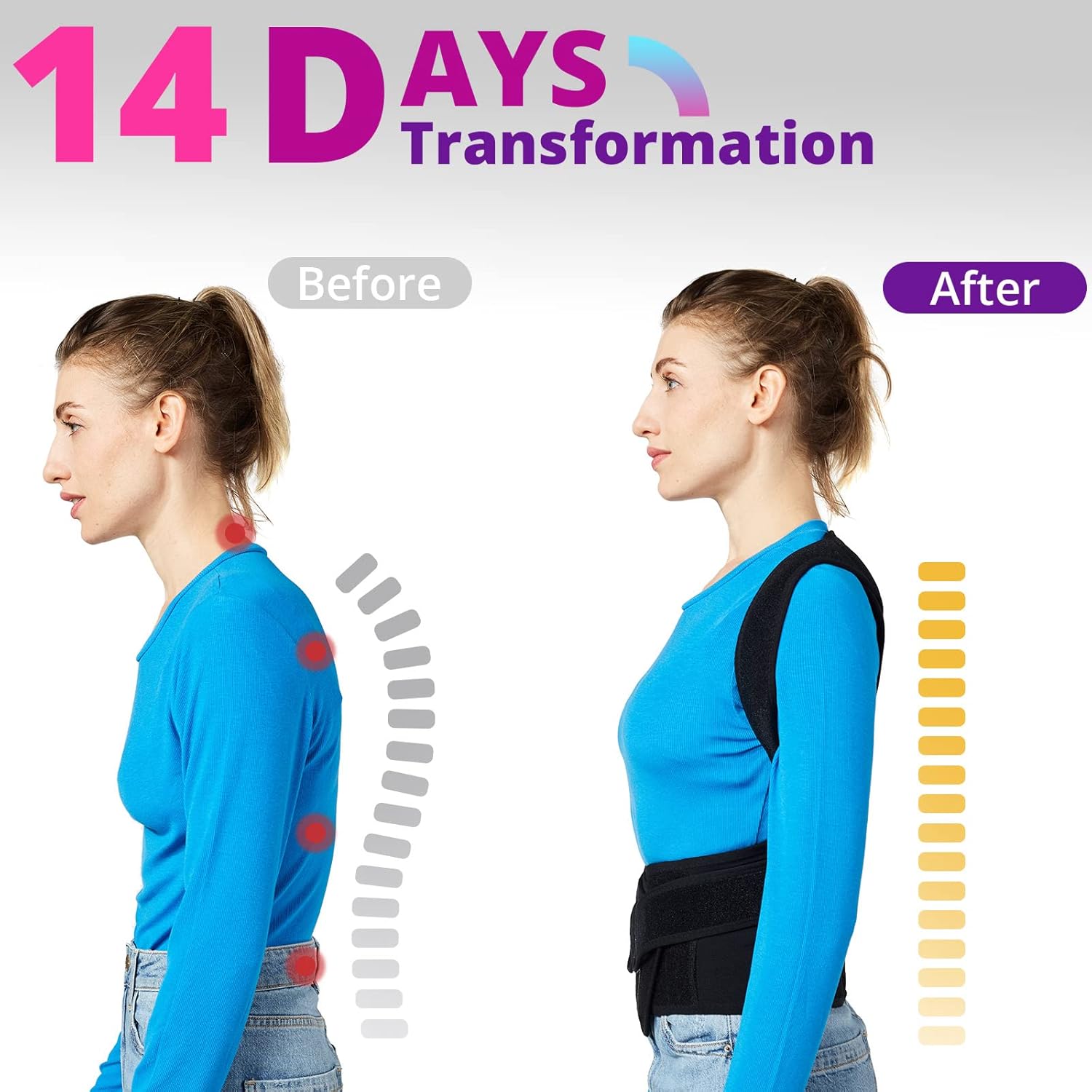 FitGuard Pro Back Brace Posture Corrector for Women and Men, Shoulder Straightener, Adjustable Full Back Support, Upper and Lower Back Pain Relief - Scoliosis, Hunchback, Hump, Thoracic, Spine Correc
