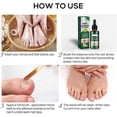 thumbnail image 5 of Ginger Nail Fungus Treatment Extra Strength, Anti Fungal Nail Treatment for Toenails and Fingernails, Toenail Fungal Treatment for Nail Repair, 5 of 5