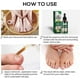 thumbnail image 5 of Ginger Nail Fungus Treatment Extra Strength, Anti Fungal Nail Treatment for Toenails and Fingernails, Toenail Fungal Treatment for Nail Repair, 5 of 5