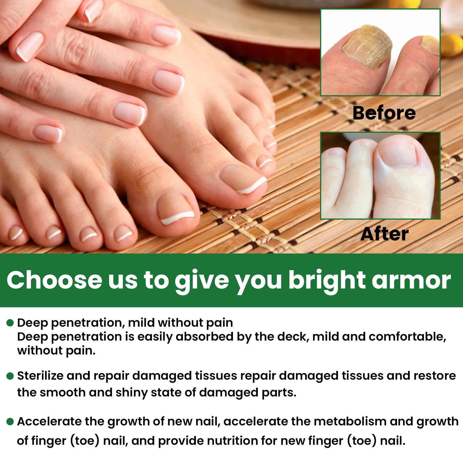 Alvantor Nail Repair For Fungal Treatment, Gray Removing Nourishing Lotion For Hands and feet, 1 fl oz