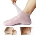 thumbnail image 3 of shenmeida 1 Pair Silicone Socks, Socks Foot Anti-cracking Protector Foot Care Tool Prevention Socks for Dry Feet Ankles Cracked Heel Repair Foot Socks, 3 of 8